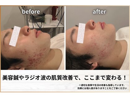 ニクス(nyx)の写真
