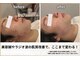 ニクス(nyx)の写真