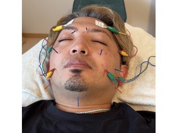 ソメイユ(Sommeil)の写真/鹿児島駅近くでメンズもリフレッシュ！電気美容鍼とマッサージで心身を整える体験を☆