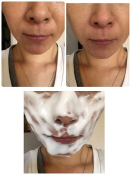 シャンス 輝き(CHANCE 輝き)/ファンデいらずの毛穴レス肌