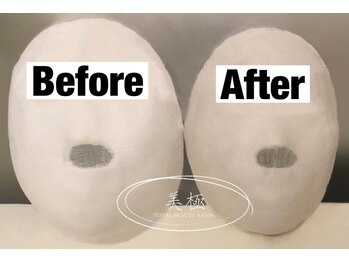 美極 トータルビューティー(美極 TOTAL BEAUTY)/恵比寿/小顔コルギ/エステ/