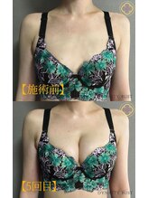 エークレッセント(A-crescent)/