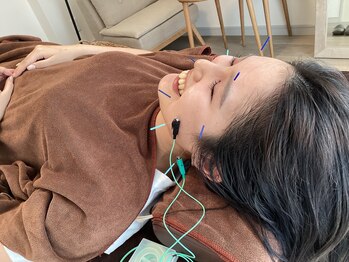 ハリファ鍼灸院 横浜関内院(HariFa鍼灸院)/美容施術