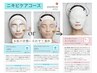 【繰り返す肌荒れニキビにお悩みの方】ニキビケア角質ケアコース60分 