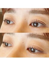 ホーム(HOME)/ラッシュリフト