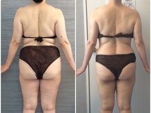 美容整体ウェリナ あま甚目寺院/小顔矯正/骨盤矯正/美脚サロン