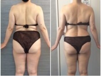 美容整体ウェリナ あま甚目寺院/小顔矯正/骨盤矯正/美脚サロン