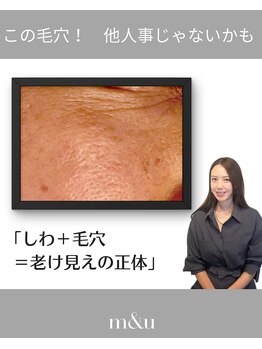 エムアンドユウ(m&u)/老いを感じた時はまずは毛穴から