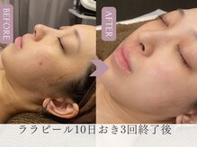 韓国肌管理メニュー多数！肌質に合わせ最善の施術で美しく変化