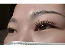 ノアカラー(NOA color)/バインドロック