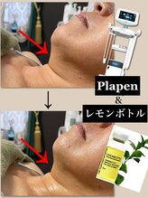 リーシャ(Reesha)/レモンボトル