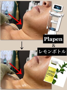 リーシャ(Reesha)/レモンボトル