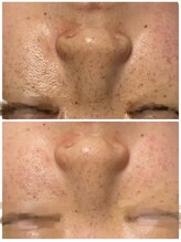 リノ ポノ(Lino Pono)/ハーブの力