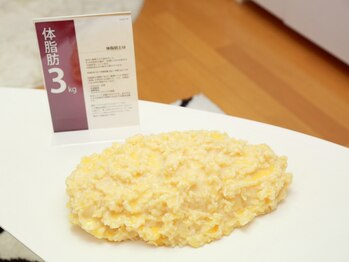 耳つぼダイエットサロン Ailefleur【エルフルール】の写真/【一人ひとりのお悩みに合わせた耳つぼ施術をご提供◎】耳つぼ+食事指導で健康的なお身体に導きます♪