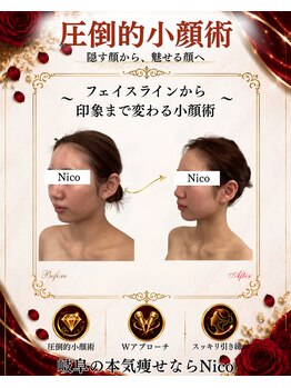 ニコ 岐南本店(Nico)の写真/[痩身/小顔専門店]だからできる"圧倒的結果出し"背中から整える小顔術｜理想のフェイスラインへ