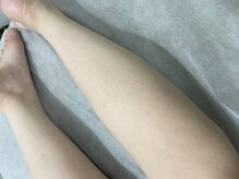 ナノハナ/鹿沼市の全身脱毛美容室ナノハナ