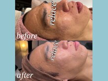 リレイスフクオカ(RelaceFUKUOKA)/ハーブ　ビフォーアフター