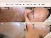 ●Ｂefore→Ａfter