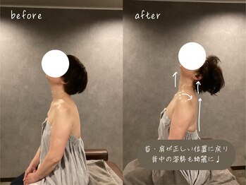 首の休日/ビフォーアフター