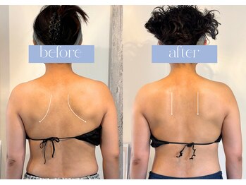 ステラ(STELLA)/上半身ほぐしで天使の羽GET!