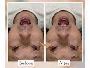 くすの木 治療院/まっすぐ口が開かなくて…