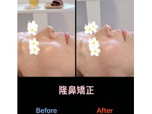 美容矯正サロン レレポノ(LELEPONO)/