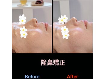 美容矯正サロン レレポノ(LELEPONO)/