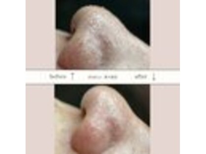 アネラ(ANELA)の写真