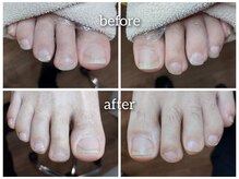 爪切り屋 足楽/届かない足爪切り