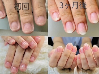 ケアビューティサロン(care beauty salon)の写真