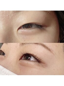 エイミー(eimy)/アディクトカール