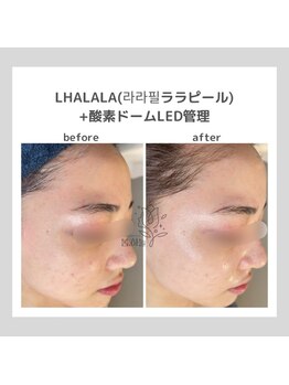 ポムハヌル(pom.haneul)/韓国肌管理室