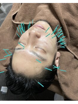 きらめき鍼灸治療院/男性の方も大歓迎です!