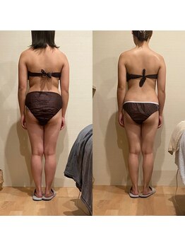 トトノエル(TOTONOEL)/脂肪燃焼×筋膜リリース