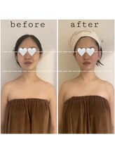 リブ シャルム(Lib Charm)/小顔コルギ1回施術