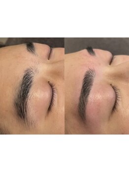 メンズフェイシャル