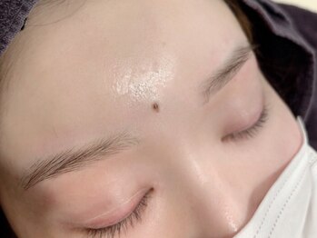 スラッシュ アイ(SLASH eye)の写真/産毛や古い角質をしっかり落としトーンUP◆産毛ケアでお肌のお悩みもより少なく！お気軽にお試しください♪