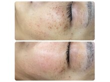 ビラ ベルダ(Bira Beldad)の雰囲気（シミケアや肌荒れなどお気軽にご相談ください♪）