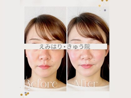 えみはりきゅう院の写真