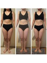 サロン ド ディジェール(Salon de Degel)/2ヶ月目測定/ブライダル