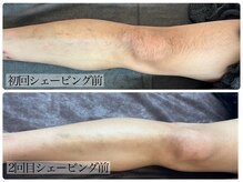 ベルミノン(BelleMignon)