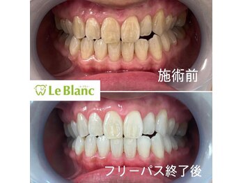 ルブラン 奈良店(Le Blanc)/ムラなく艶も出る！