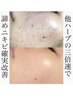 【肌質改善ハーブピーリング】16g 22,000円
