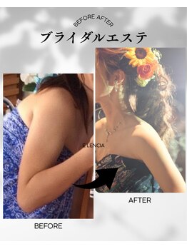 エレンシア(E'lencia)の写真/《ブライダルお試し￥5000》一生に一度のドレス姿を美しく!花嫁様の全ての願いを叶えるスペシャルプラン♪