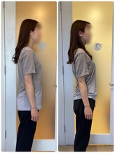 アールプラス 五反田店(R-plus)/ブライダル整体のお客様の変化