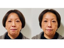 フェイスドット 梅田院(Face.)/