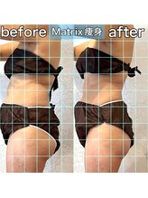 サロンデイジー(Salon Daisy)/Matrix痩身★施術一回