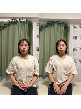 整体院りょう 高槻市/#肌質改善#むくみ