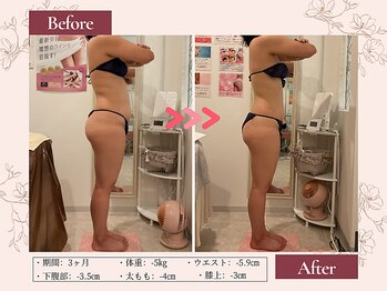 リムサロン(RIMSALON)/