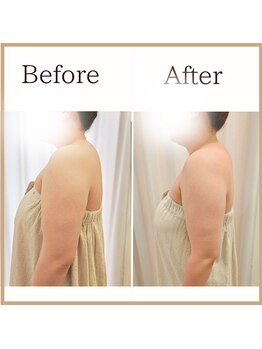 サロンルーチェ(Salon Luce)/ビフォーアフター/施術回数9回